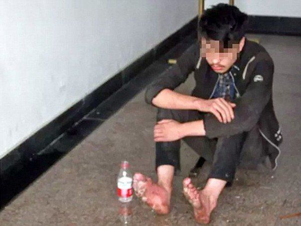 У китайского геймера начали гнить ноги после шестидневного игрового марафона