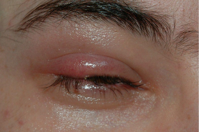 8 сигналов, при помощи которых глаза предупреждают о проблемах со здоровьем!