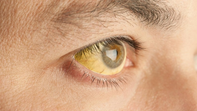 Эти 8 сигналов, при помощи которых глаза предупреждают о проблемах со здоровьем! Обязательно обратите внимание!❗