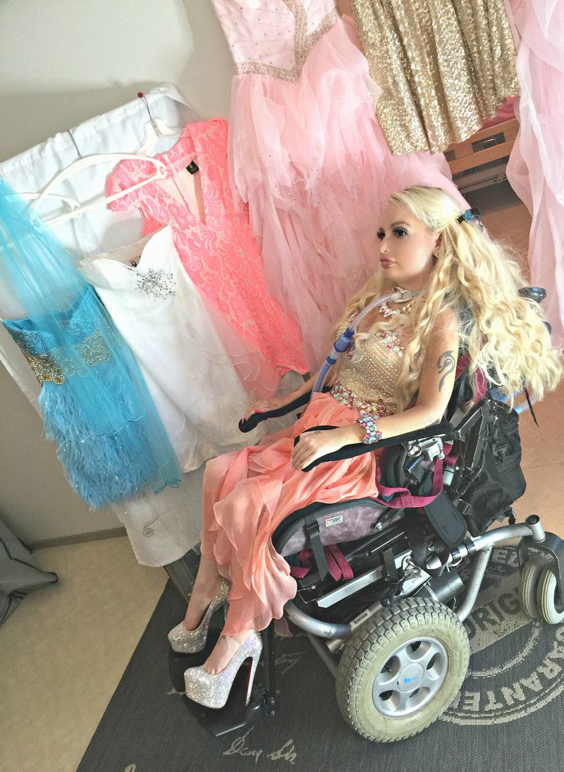 Парализованная девушка в инвалидном кресле стремится стать похожей на Барби
